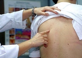 Un médico señala un lunar en la espalda de un paciente.